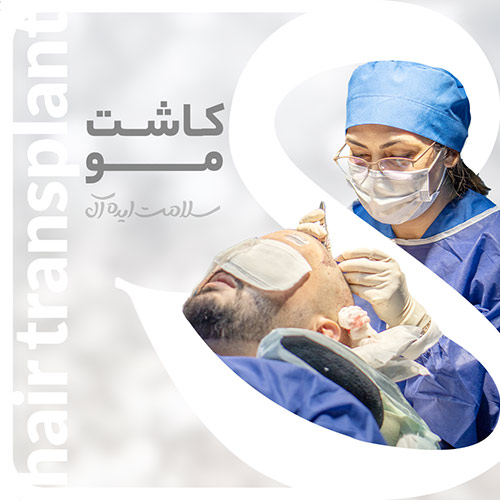 خدمات کاشت مو مشهد در کلینیک سلامت ایده آل